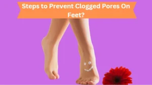 Clogged Pore On Foot