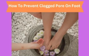 Clogged Pore On foot