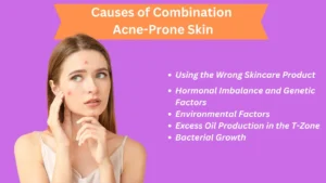 Combination acne-prone skin