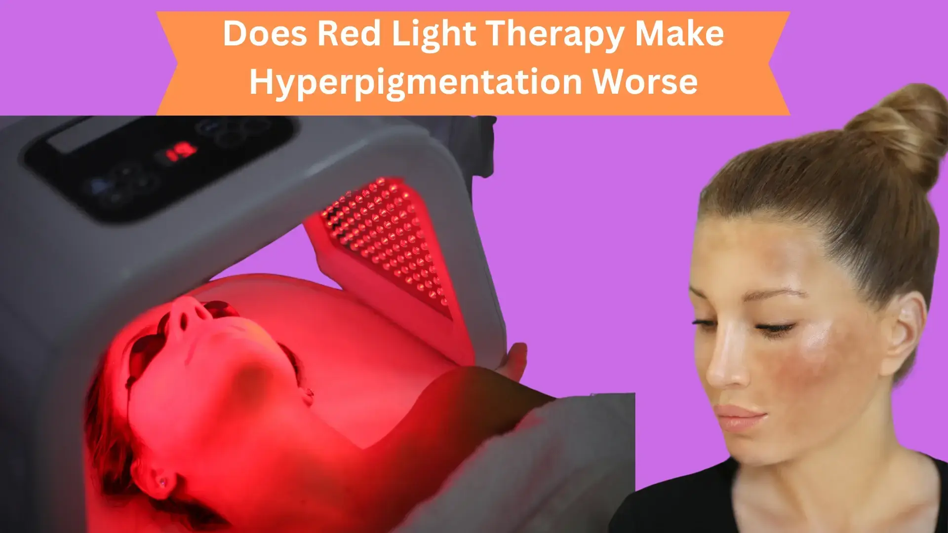 Does Red Light Therapy Make Hyperpigmentation Worse