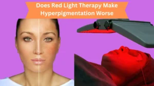 Does Red Light Therapy Make Hyperpigmentation Worse